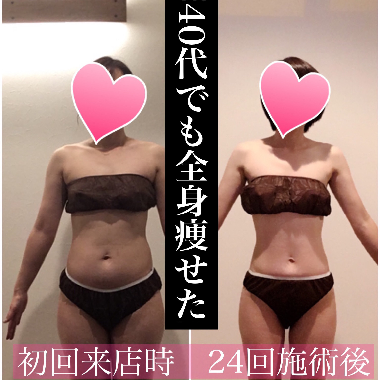 夏までにスッキリしたいなら | 松戸市の骨盤矯正・ダイエット